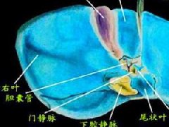 淤胆型肝炎的症状临床表现_中医淤胆型肝炎怎么办