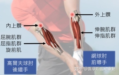 肱骨内上髁炎是什么症状和表现用中医来解释
