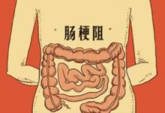 肠梗阻是怎样发生的?