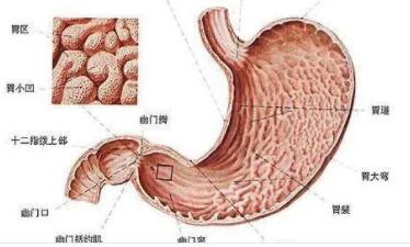 肠梗阻病人为什么早期肠鸣音亢进,以后肠鸣音减弱,最后可消失?