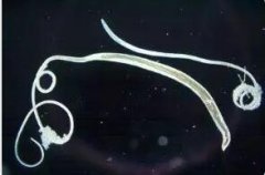 鞭虫有什么特点?对人有什么危害性?