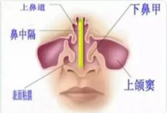 什么是鼻窦?鼻窦的解剖特点在临床上有什么意义?