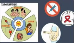 艾滋病病毒(HIV)是通过什么途径传播的?